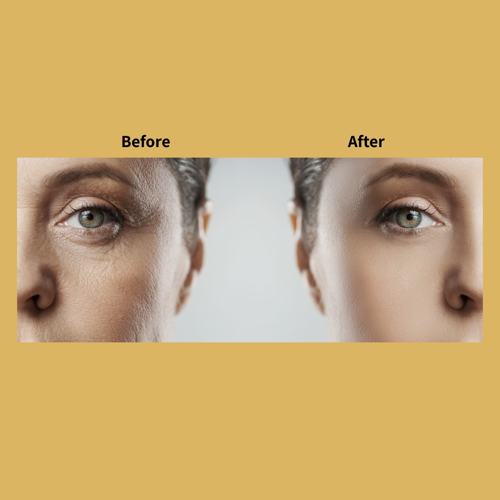Laser Rejuvenation Before and After Photos | Soleil Medical & Beauty Spa in Portland, OR