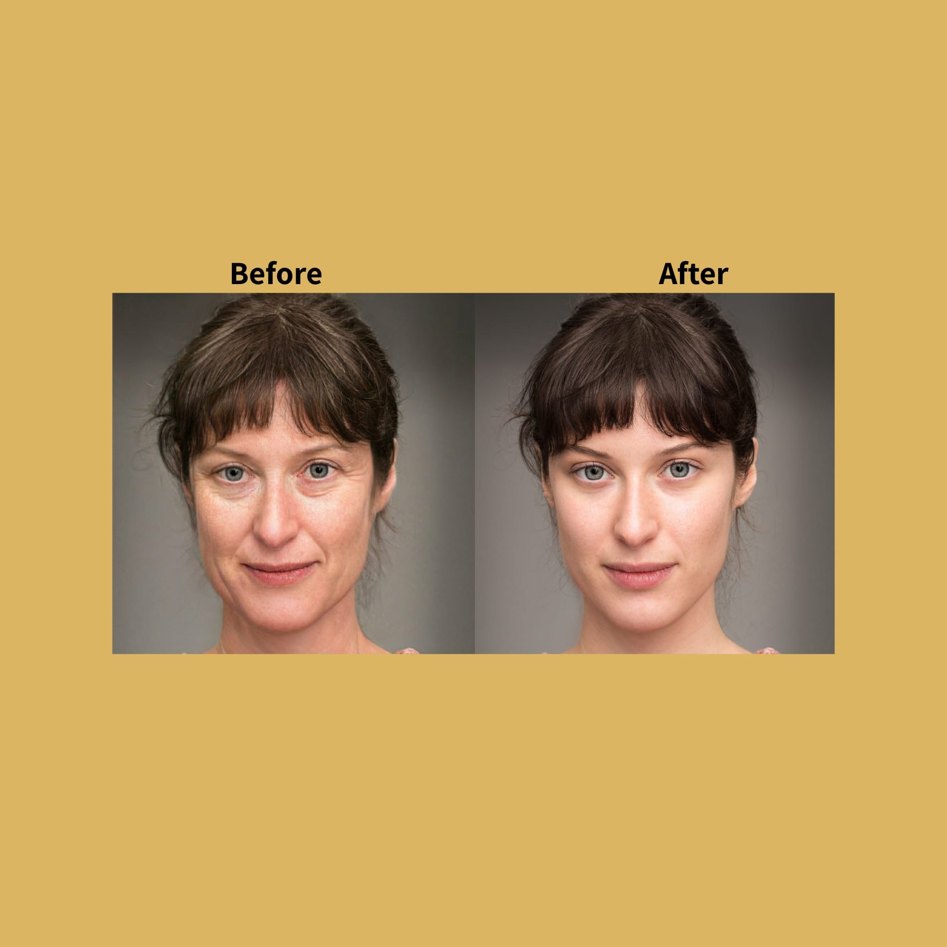 Laser Rejuvenation Before and After Photos | Soleil Medical & Beauty Spa in Portland, OR