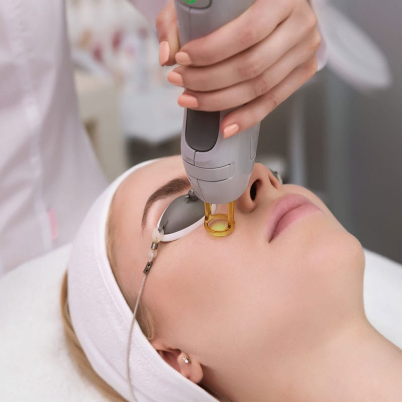 Women getting CO2_Fractional_Laser resurfacing Treatment | Soleill Medical & Beauty Spa in Portland, OR