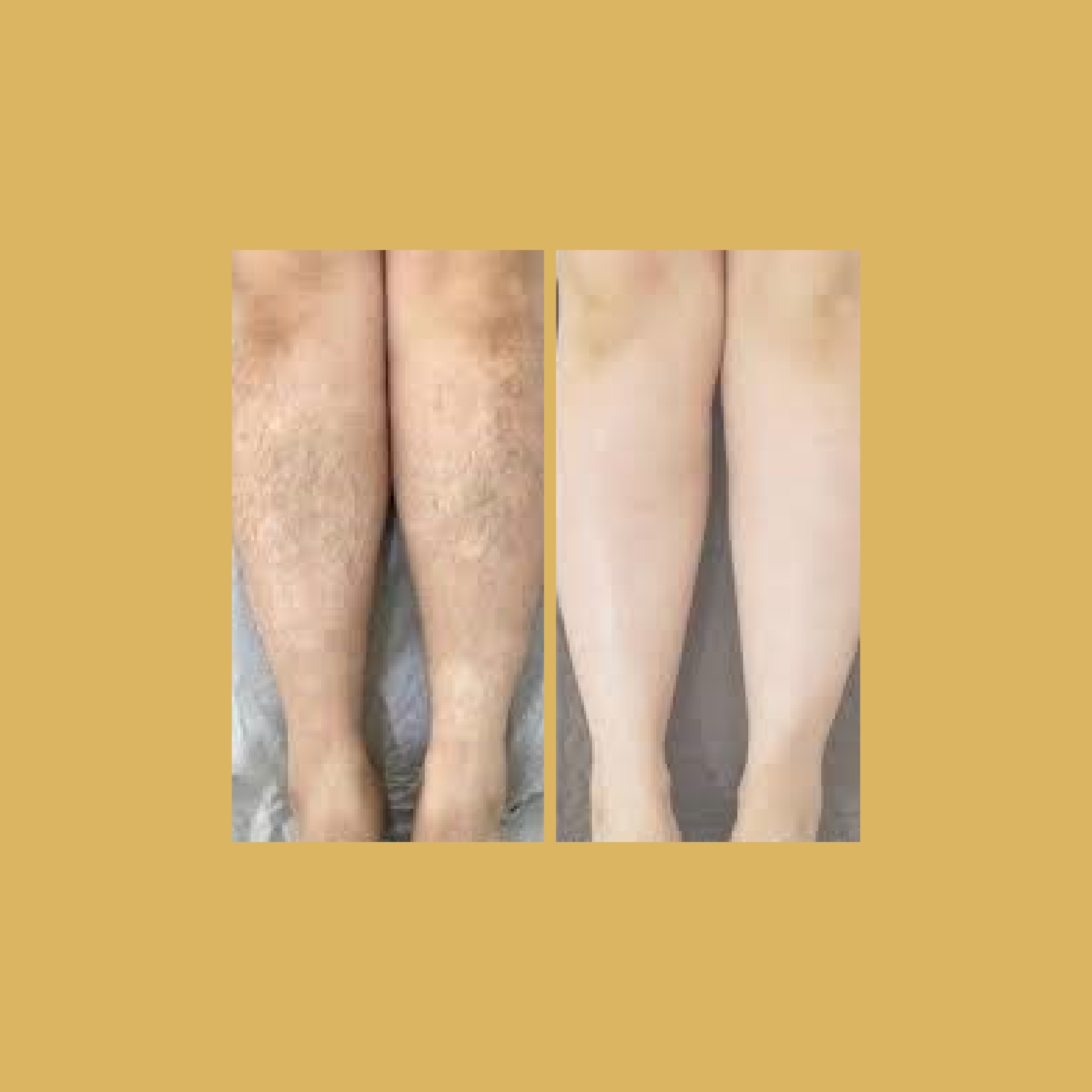 Threading-and-Waxing-before-and-after-eight-Soleilmedicalspapdx-_In_Portland_Oregon