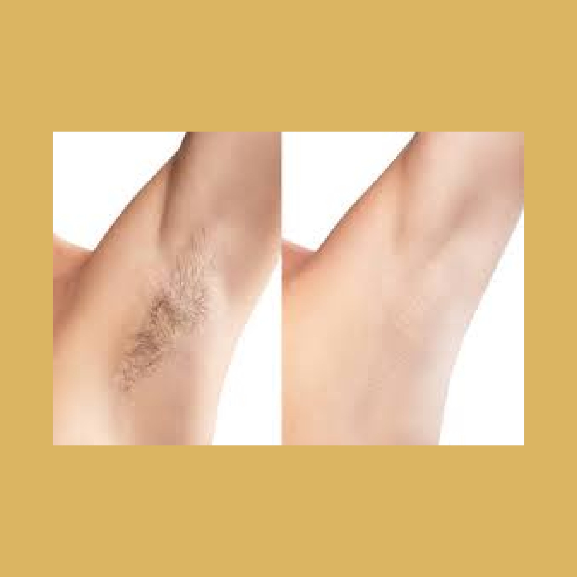 Threading-and-Waxing-before-and-after-seven-Soleilmedicalspapdx-_In_Portland_Oregon