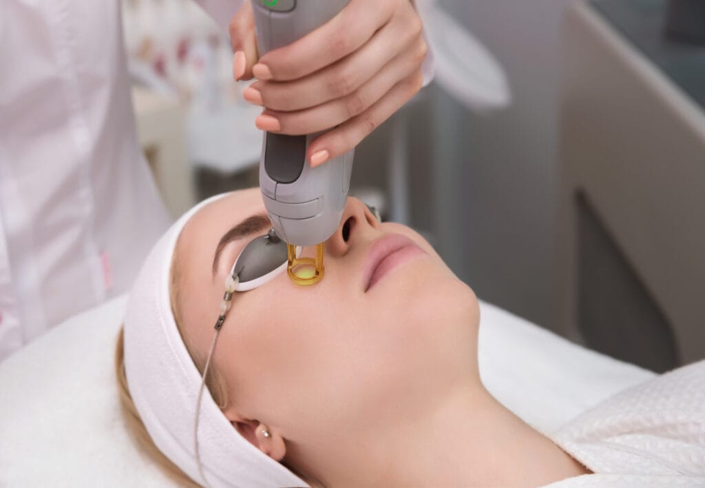 CO2 Fractional Laser by Soleil Medical Spa