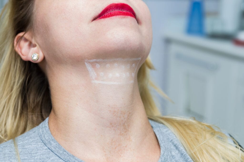 Get Kybella Injections in Portland, OR | Soleil Medical Spa