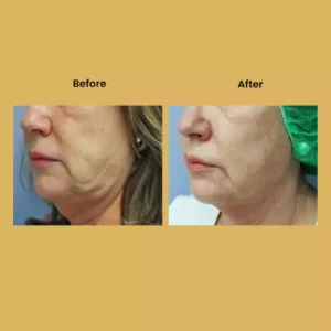 a collage of a woman's face