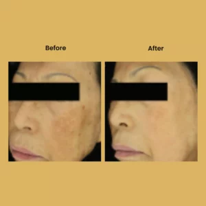a woman's face before and after