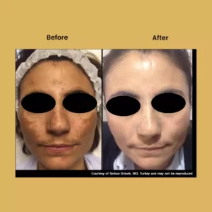 a woman with black eyes