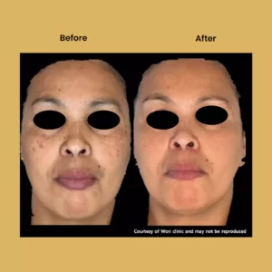 a woman with a black mask