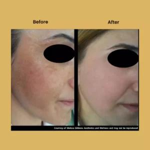 a woman's face before and after a photo