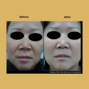 a woman with black eyes