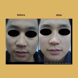 a man with black eyes