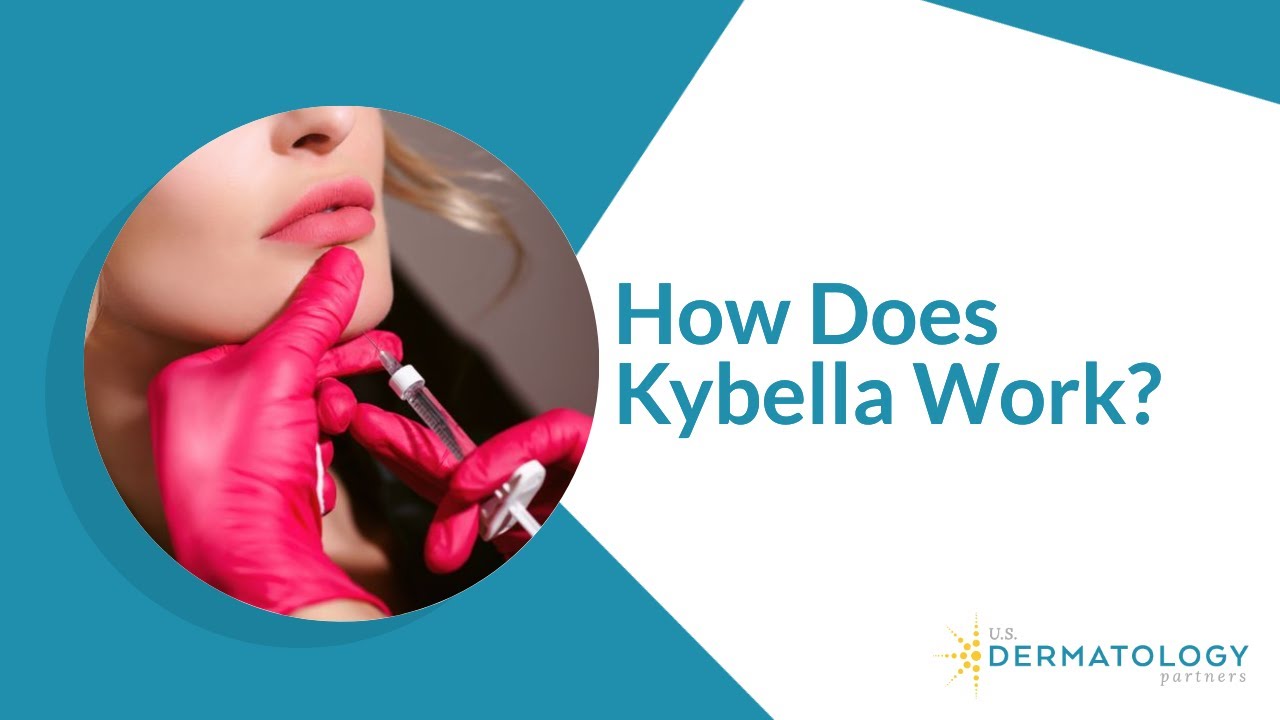 Kybella in Portland, OR