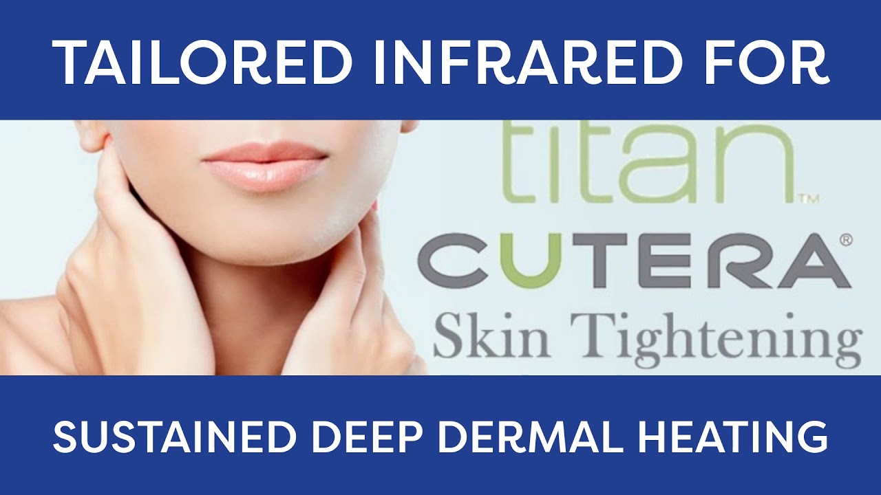 Titan Non-Surgical Facelift