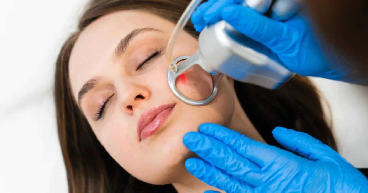 Women receiving CO2 Fractional Laser In Portland, OR