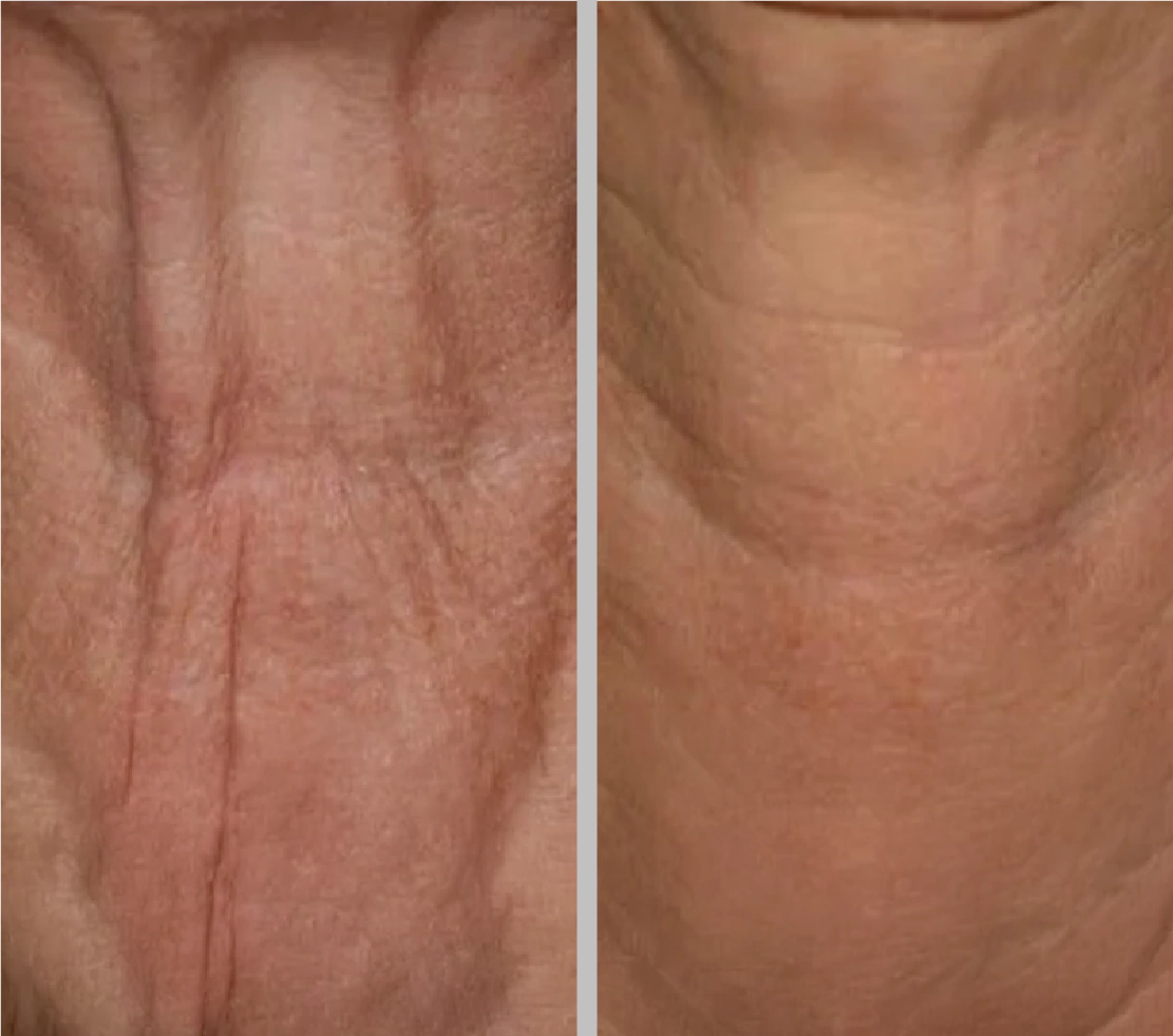 Micro Tox Before after-03