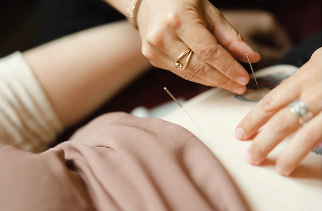 Acupuncture Services in Portland, OR (11)